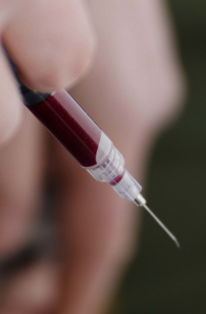 V-v blood sample